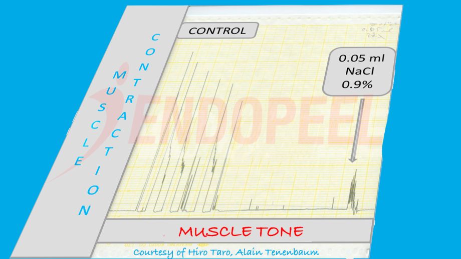 Muscle Contraction and Muscular Tonus Control