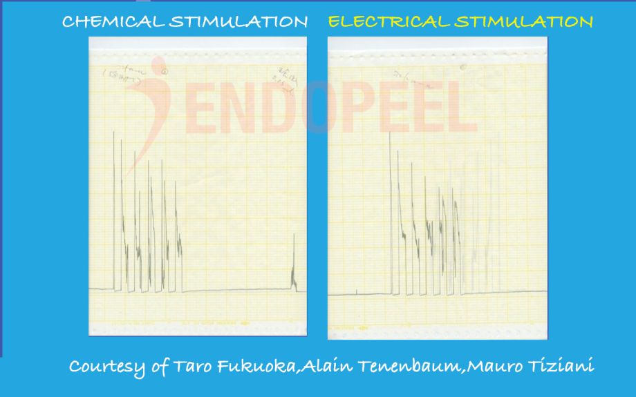 chemical & electrical stimulation of the muscle